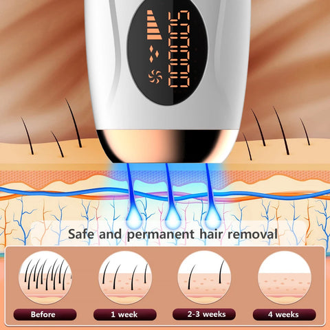 Depilação a Laser IPL-  Pulso de Luz Forte com Resultados Eficazes