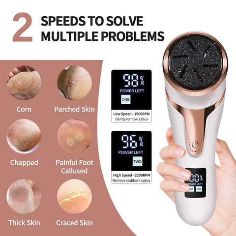 Portable Electric Vacuum Callus Remover - Efficient Care for Hard and Dead Skin