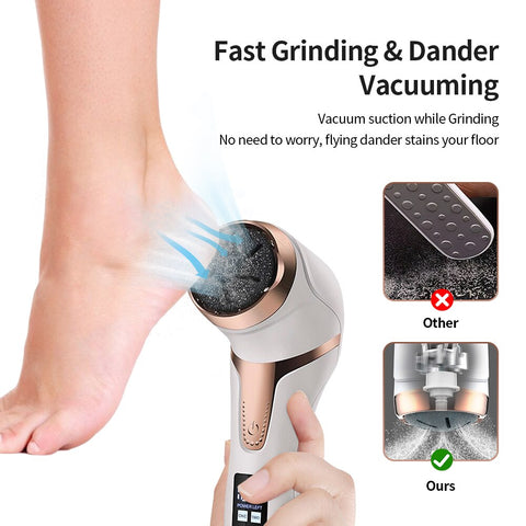 Portable Electric Vacuum Callus Remover - Efficient Care for Hard and Dead Skin